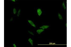 Image no. 3 for anti-Leucine Rich Repeat (In FLII) Interacting Protein 1 (LRRFIP1) (AA 675-785) antibody (ABIN465979)