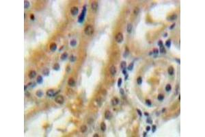 IHC-P analysis of Kidney tissue, with DAB staining. (Betacellulin antibody  (AA 32-118))