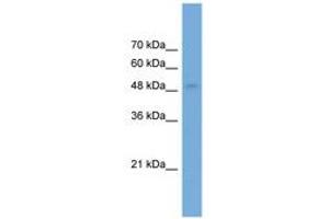 Image no. 1 for anti-Neuronal Pentraxin II (NPTX2) (AA 179-228) antibody (ABIN6746446) (NPTX2 antibody  (AA 179-228))