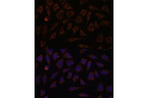 Immunofluorescence analysis of L929 cells using VILL antibody (ABIN7271325) at dilution of 1:100. (VILL antibody  (AA 637-856))