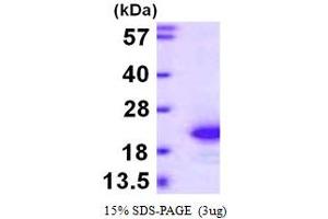 SDS-PAGE (SDS) image for Fibroblast Growth Factor 1 (Acidic) (FGF1) (AA 16-155) protein (His tag) (ABIN666797)