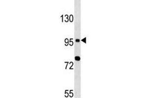 TLR6 antibody western blot analysis in MCF-7 lysate (TLR6 antibody  (AA 1-30))
