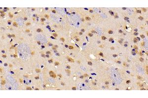 ABCA2 antibody  (AA 2201-2434)