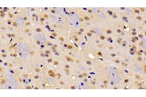 Detection of ABCA2 in Mouse Cerebrum Tissue using Polyclonal Antibody to ATP Binding Cassette Transporter A2 (ABCA2) (ABCA2 antibody  (AA 2201-2434))