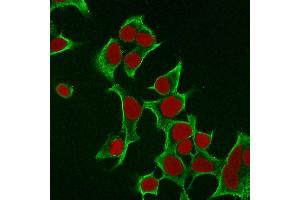 Immunofluorescence Analysis of MCF cells labeling Cytokeratin 8 withKRT8 Mouse Monoclonal Antibody (B22. (KRT8 antibody)