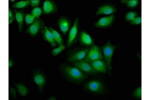 Immunofluorescence staining of A549 cells with ABIN7175871 at 1:100, counter-stained with DAPI. (WWOX antibody  (AA 1-180))