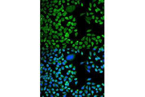 Immunofluorescence (IF) image for anti-TIA1 Cytotoxic Granule-Associated RNA Binding Protein (TIA1) antibody (ABIN1882364) (TIA1 antibody)