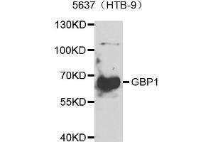 Western blot analysis of extract of 5637 cell lines, using GBP1 antibody. (GBP1 antibody)