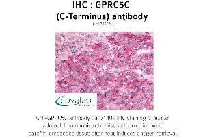 Image no. 1 for anti-G Protein-Coupled Receptor, Family C, Group 5, Member C (GPRC5C) (C-Term), (Cytoplasmic Domain) antibody (ABIN1735220) (GPRC5C antibody  (C-Term, Cytoplasmic Domain))