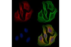 ABIN6255389 and ABIN6267301 staining H2O2 treated Hela cells by IF/ICC. (EIF2S1 antibody  (pSer51))