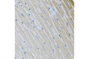 Immunohistochemistry of paraffin-embedded mouse heart using USP25 antibody at dilution of 1:100 (x40 lens). (USP25 antibody)