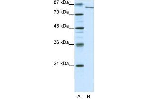 WB Suggested Anti-FBXL11 Antibody Titration: 0. (KDM2A antibody  (N-Term))