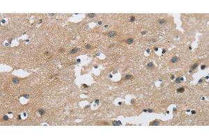 Immunohistochemistry of paraffin-embedded Human brain using FGF9 Polyclonal Antibody at dilution of 1:40 (FGF9 antibody)