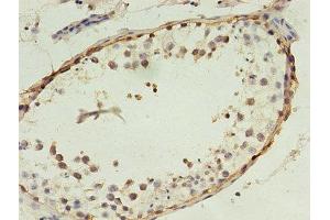 Immunohistochemistry of paraffin-embedded human testis tissue using ABIN7159264 at dilution of 1:100