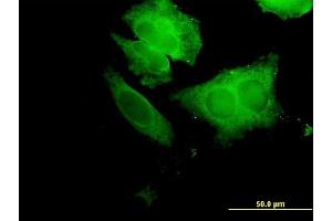 Immunofluorescence of purified MaxPab antibody to ECH1 on HeLa cell. (ECH1 antibody  (AA 1-328))