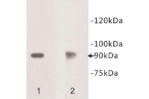 Western Blotting (WB) image for anti-Deleted in Colorectal Carcinoma (DCC) antibody (ABIN1854949) (DCC antibody)