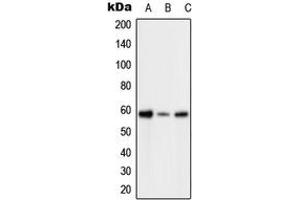 Western blot analysis of PFKFB2 (pS483) expression in HeLa H2O2-treated (A), SP2/0 H2O2-treated (B), H9C2 H2O2-treated (C) whole cell lysates.
