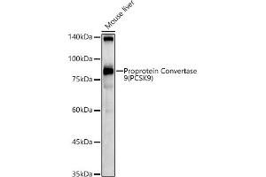 Western blot analysis of extracts of Mouse liver, using Proprotein Convertase 9(PCSK9) antibody (ABIN6133851, ABIN6145328, ABIN6145330 and ABIN6223837) at 1:1000 dilution. (PCSK9 antibody  (C-Term))