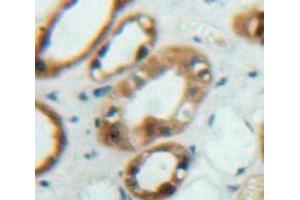 Used in DAB staining on fromalin fixed paraffin-embedded Kidney tissue (FRS2 antibody  (AA 268-453))