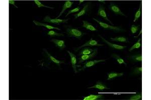 Immunofluorescence of monoclonal antibody to PBK on HeLa cell. (PBK antibody  (AA 122-229))