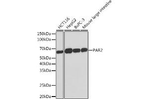 Western blot analysis of extracts of various cell lines, using P Rabbit mAb (ABIN1683023, ABIN7101760, ABIN7101761 and ABIN7101762) at 1:1000 dilution. (F2RL1 antibody)