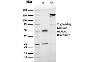 SDS-PAGE Analysis Purified Prohibitin Mouse Monoclonal Antibody (PHB/3193).
