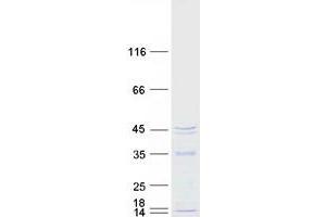 Mitochondrial rRNA Methyltransferase 1 Homolog (MRM1) protein (Myc-DYKDDDDK Tag)
