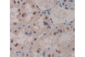 Used in DAB staining on fromalin fixed paraffin- embedded Kidney tissue (Mre11 antibody  (AA 375-609))