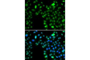 Immunofluorescence analysis of MCF-7 cells using ING5 antibody.