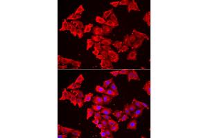 Immunofluorescence analysis of HeLa cells using SMPX antibody (ABIN6292730). (SMPX antibody)