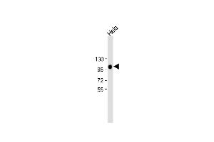 All lanes : Anti-LP2 Antibody at 1:2000 dilution Lane 1:Hela whole cell lysate Lysates/proteins at 20 μg per lane. (LAMP2 antibody)