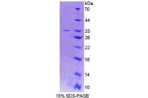 SDS-PAGE (SDS) image for Thymocyte Nuclear Protein 1 (THYN1) (AA 1-226) protein (His tag) (ABIN4989541)