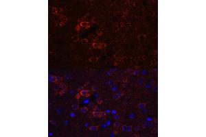 Immunofluorescence analysis of mouse brain using EL Rabbit pAb (ABIN6134651, ABIN6140118, ABIN6140119 and ABIN6221704) at dilution of 1:100 (40x lens). (HuC/ELAVL3 antibody  (AA 1-100))