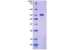 SDS-PAGE (SDS) image for Chitotriosidase (CHIT1) (AA 193-466) protein (His tag) (ABIN4990803)