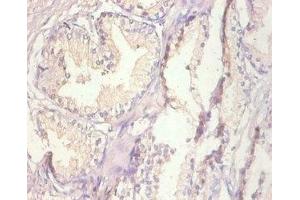 Immunohistochemistry of paraffin-embedded human prostate tissue using ABIN7159509 at dilution of 1:100 (MT1A antibody  (AA 1-59))