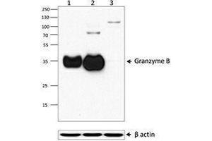Western Blotting (WB) image for anti-Granzyme B (GZMB) (AA 21-247) antibody (ABIN2666249) (GZMB antibody  (AA 21-247))