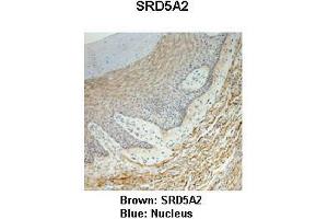 Sample Type :  Monkey vagina   Primary Antibody Dilution :   1:25   Secondary Antibody:  Anti-rabbit-HRP   Secondary Antibody Dilution:   1:1000   Color/Signal Descriptions:  Brown: SRD5A2 Blue: Nucleus   Gene Name:  SRD5A2   Submitted by:  Jonathan Bertin, Endoceutics Inc. (SRD5A2 antibody  (N-Term))