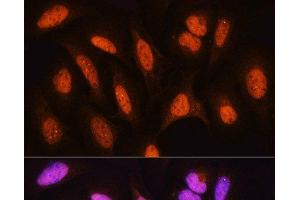Immunofluorescence analysis of U2OS cells using HSPA2 Polyclonal Antibody at dilution of 1:100. (HSPA2 antibody)