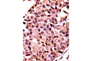 Image no. 2 for anti-Protein Phosphatase 3, Catalytic Subunit, gamma Isozyme (PPP3CC) (N-Term) antibody (ABIN360812)
