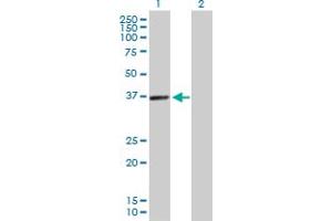 Western Blot analysis of PDLIM1 expression in transfected 293T cell line by PDLIM1 MaxPab polyclonal antibody. (PDLIM1 antibody  (AA 1-329))