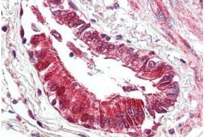 Human Lung, Respiratory Epithelium (formalin-fixed, paraffin-embedded) stained with BECN1 antibody ABIN461895 at 5 ug/ml followed by biotinylated goat anti-rabbit IgG secondary antibody ABIN481713, alkaline phosphatase-streptavidin and chromogen.