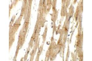 Immunohistochemistry of MLIP in human heart tissue with MLIP antibody at 5 ug/mL. (MLIP antibody  (C-Term))