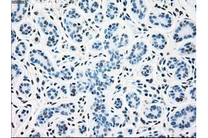 Immunohistochemical staining of paraffin-embedded breast tissue using anti-SSB mouse monoclonal antibody. (SSB antibody)