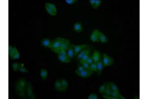 Immunofluorescence staining of HepG2 cells with ABIN7142697 at 1:200, counter-stained with DAPI. (PFKFB4 antibody  (AA 266-368))