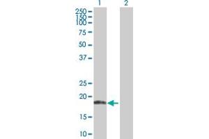 Western Blot analysis of ANK1 expression in transfected 293T cell line by ANK1 MaxPab polyclonal antibody. (Erythrocyte Ankyrin antibody  (AA 1-155))