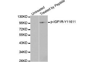 Western Blotting (WB) image for anti-Insulin-Like Growth Factor 1 Receptor (IGF1R) (pTyr1161) antibody (ABIN1870257) (IGF1R antibody  (pTyr1161))