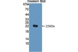 Figure. (HVEM antibody  (AA 41-209))