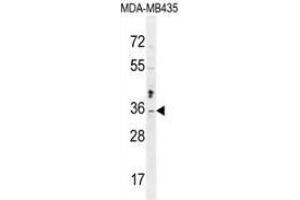 Western blot analysis in MDA-MB435 cell line lysates (35ug/lane) using Metaxin-2 Antibody (C-term). (MTX2 antibody  (C-Term))