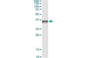 Immunoprecipitation of PRSS8 transfected lysate using anti-PRSS8 monoclonal antibody and Protein A Magnetic Bead , and immunoblotted with PRSS8 MaxPab rabbit polyclonal antibody. (PRSS8 antibody  (AA 1-343))