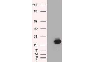 Western Blotting (WB) image for anti-Chromosome 21 Open Reading Frame 59 (C21orf59) antibody (ABIN1497042)